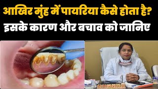 मुंह में पायरिया से कैसे छुटकारा पाएंHow to get rid of pyorrhea in mouth  Manish Chandra [upl. by Cherianne]