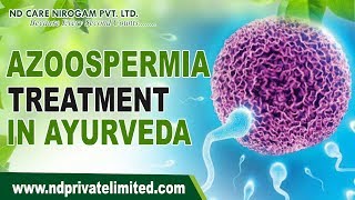 Azoospermia Treatment concept of Dr Navdeep Sharma [upl. by Alat]