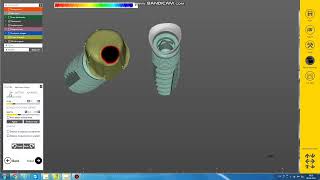 Fastest Exocad Video Tutorial  Custom Abutment Design and Anatomic Crowns [upl. by Chara]