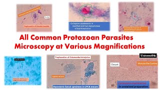 All Common Protozoan Parasites under the Microscope GiardiaAmoeba TrichomonasCyclosporaCryptosp [upl. by Samuel]