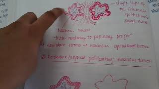 surface epithelial tumours of ovary  Gynecology [upl. by Yrhcaz]