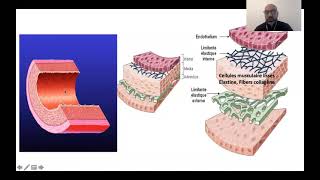 01 Rhumatisme ariculaire aigu Dr M Chettibi  Cardio [upl. by Milly]