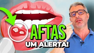 O que significa ter AFTAS e como evitálas 🔴 [upl. by Rayford]