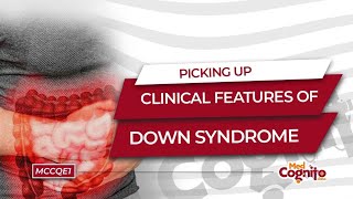 Picking Up Clinical Features of Down Syndrome  MCCQE1 [upl. by Aderf]