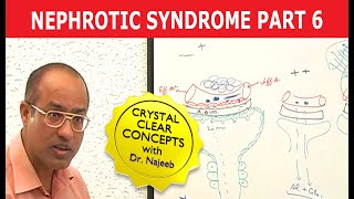 Nephrotic Syndrome  Part 6🩺 [upl. by Enajaras113]