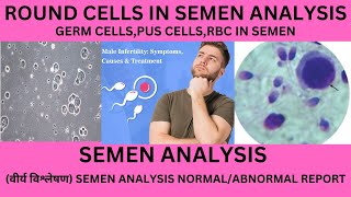 ROUND CELLS IN THE SEMEN ITS SIGNIFICANCEGERM CELLSWBC RBC EPITHELIAL CELLS IN SEMEN ANALYSIS [upl. by Phil722]