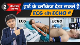 Can ECG and echocardiogram detect heart blockageMust Know facts [upl. by Nylhsa]