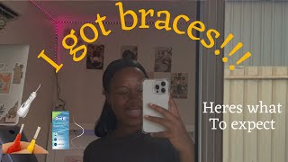 I GOT CERAMIC BRACES what to expect  my experience  tips and tricks [upl. by Annerb]