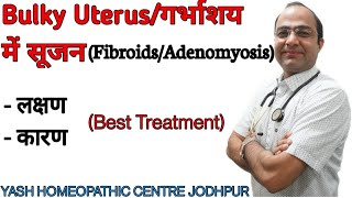 Bulky Uterus  Enlarged Uterus  Fibroid Adenomyosis  Treatment without surgery [upl. by Iain]