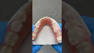 Lower TCS Unbreakable FiberFlex Partial EnvisiontecMain tcsdentalinc envisiontectcsdentalinc [upl. by Yregerg493]