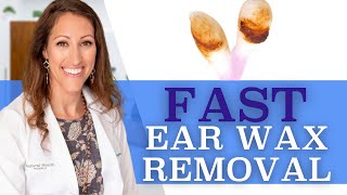 Clogged Ears  How to Remove Ear Wax At Home With Hydrogen Peroxide [upl. by Masao]