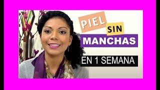 Como quitar las manchas en 1 semana ✅ FUNCIONA 100 ✅  YOLIANA GAMBOA [upl. by Ybhsa]