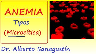 Anemias 1 síntomas y tipos  Anemia Microcítica [upl. by Howlend]