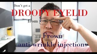 How to avoid a droopy eyelid after frown antiwrinkle injections [upl. by Cirtemed189]