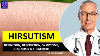 HIRSUTISM Definition Description Causes and symptoms Diagnosis amp Treatment of Hirsutism [upl. by Woodrow]