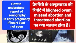 blighted ovum Incomplete or missed abortion का ultrasound रिपोर्ट मे क्या मतलब होता है [upl. by Notslar508]