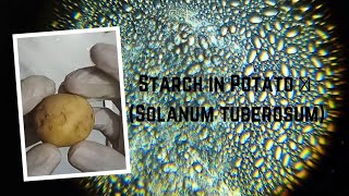 Starch grains in potato 🥔 Solanum tuberosum [upl. by Rolfston274]