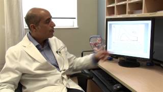 Colposcopy Educational Video with Dr Ziegler [upl. by Nnazil]