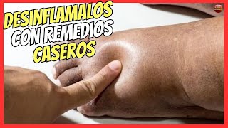 🔴 ¿COMO DESINFLAMAR LOS PIES HINCHADOS CON REMEDIOS CASEROS 🔥 [upl. by Uol]