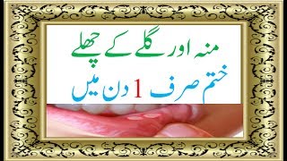 Health Tips in Urdu Moun Ke Chale Khatam Karne Ka Gharelu Totka gale ke chale [upl. by Obidiah]