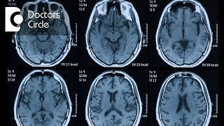 4 Tests to detect Parkinsons Disease  Dr Guruprasad Hosurkar [upl. by Adnohsed627]