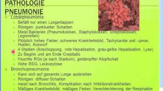 Gratis Seminar Pneumonien  Typische  atypische Pneumonien [upl. by Eicnahc]