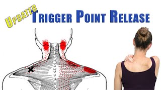 TRIGGER POINT RELEASE Upper Trapezius Levator Scapulae and Suboccipitals  UPDATED with back view [upl. by Anerys]