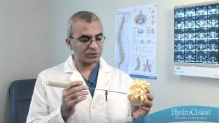 Herniated Disc Treatment Dallas Pinched Nerve Back Pain [upl. by Nayar]