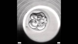 Development of an Embryo from 2PN to Blastocyst via an EmbryoScope [upl. by Besnard683]