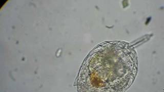 rotifer feeding on algae [upl. by Naujled]