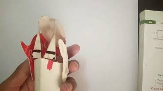 Larynx anatomy 4 Arytenoid Cartilage  TCML [upl. by Adnale]