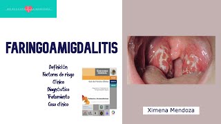 FARINGOAMIGDALITIS agentes infecciosos clínica diagnóstico tratamiento caso clínico ENARM [upl. by Liuka]