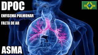 DPOC  Doença Pulmonar Obstrutiva Crônica  ASMA  FALTA DE AR  Enfisema Pulmonar [upl. by Worthy]