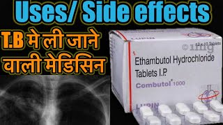 Combutol Tablet  Ethambutol Hydrochloride Tablet  TB ki Dawa  TB Medicine  Dose Side Effects [upl. by Brace]