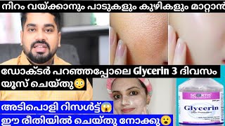 ഞെട്ടിച്ചു കളഞ്ഞു Glycerin😮Use glycerin daily for Amazing Results💯Shilpa sanjay glycerin [upl. by Icken]