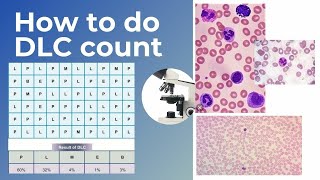 Easy way of making peripheral smear staining the smear and do the DLC [upl. by Amehsyt294]