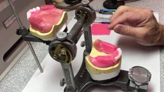 Posterior Denture Tooth SetUp Lingualized Occlusion [upl. by Gilchrist291]