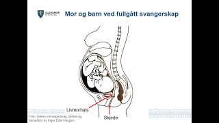 Fødselsforberedende kurs [upl. by Rainah]