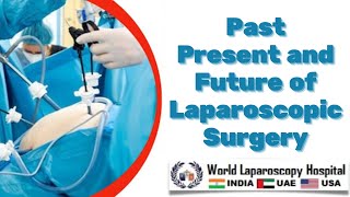 Past Present and Future of Laparoscopic Surgery  Introduction of Minimal Access Surgery [upl. by Von675]