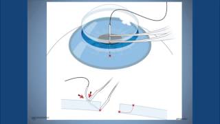 Corneal Suturing Part 1 A Curriculum for Suturing the Cornea [upl. by Teddman598]