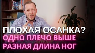 ПЛОХАЯ ОСАНКА разная длина ног перекос таза плечи на разном уровне – зачем вас этим пугают [upl. by Latty]