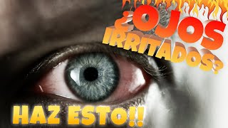 🙋🏼‍♂️ ¿ Ojos IRRITADOS la solución DEFINITIVA [upl. by Kelleher253]