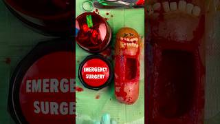 Emergency FruitSurgery  The Button is Back Giant Glizzy gives birth FoodSurgery DiscountDentist [upl. by Siegler]