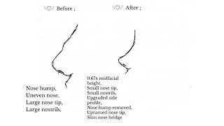 “ ᵛⁱʳᵗᵘᵃˡ ⁿᵒˢᵉ ˢᵘʳᵍᵉʳʸ “  Nose reconstruction subliminal ♡¸• Ultra Effective 🍥 [upl. by Aneeled]