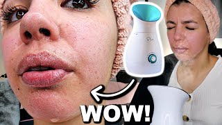 I Tested The Best FACIAL STEAMER On Amazon [upl. by Isadore548]