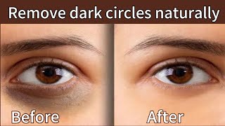 Simple home remedies for dark circles [upl. by Akirdnas]