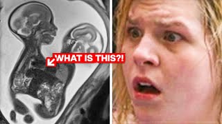 A mother does an ultrasound at 20 weeks pregnant then the doctor makes a shocking new discovery [upl. by Doe]