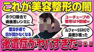 【美容整形の闇】今話題の美容整形！まさかの後遺症がヤバすぎた・・【ガルちゃんまとめ】 [upl. by Lihp]