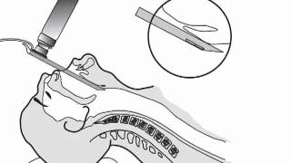 Laryngoscope Blade Use In ETI [upl. by Alger]