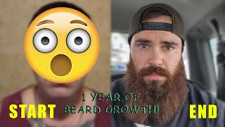 1 YEAR BEARD GROWTH TIMELAPSE [upl. by Hoppe]